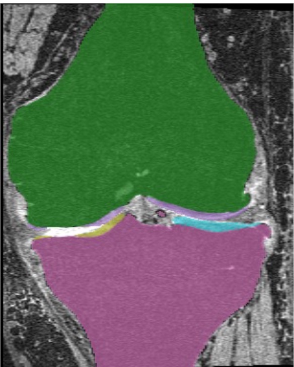 MRI Pred