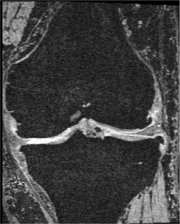 MRI Raw